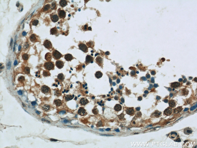 AMPK gamma 1 Antibody in Immunohistochemistry (Paraffin) (IHC (P))