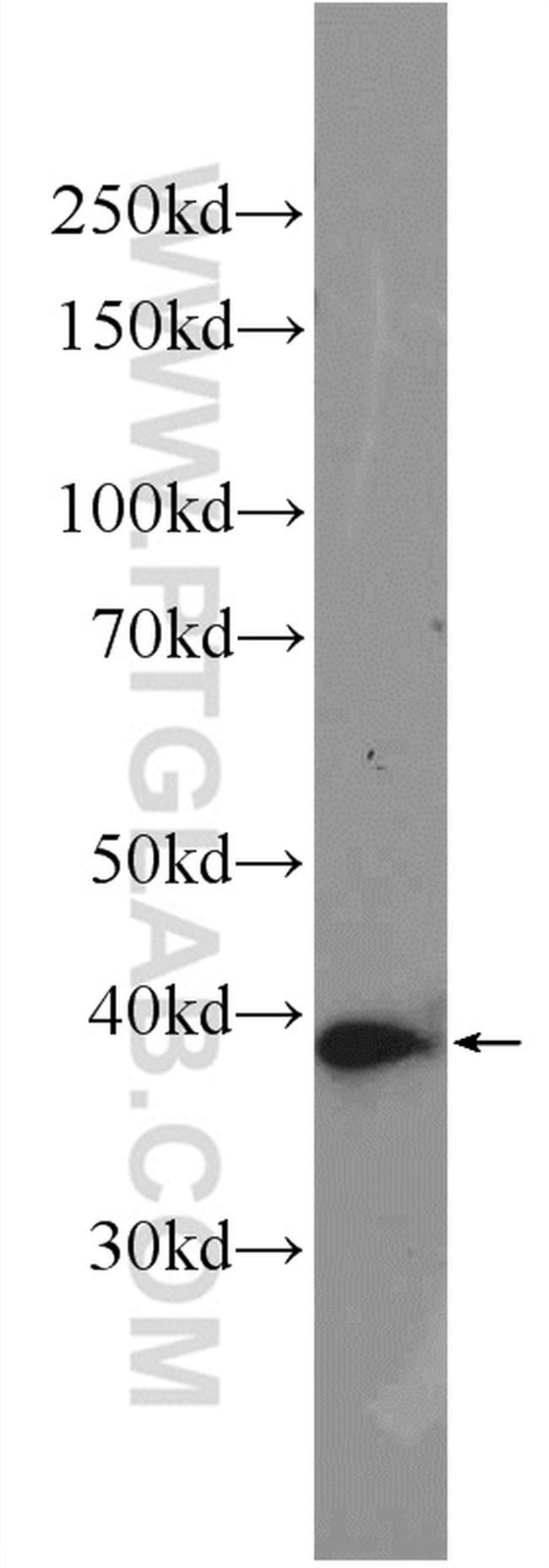 AMPK gamma 1 Antibody in Western Blot (WB)