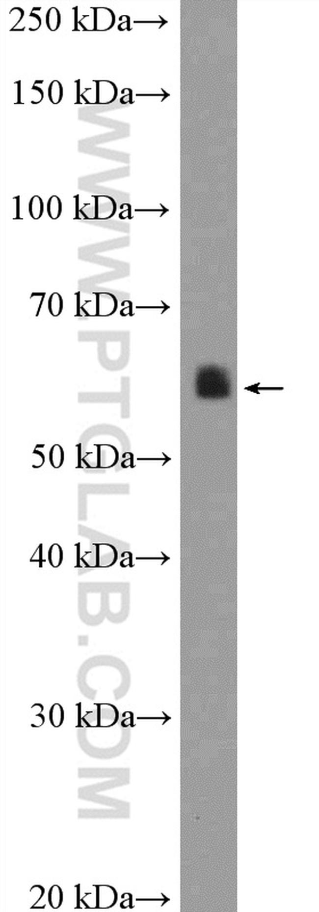 calreticulin Antibody in Western Blot (WB)