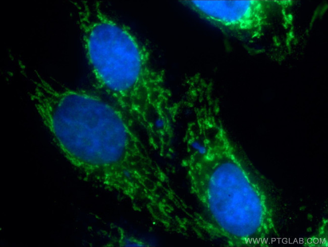 CIAO1 Antibody in Immunocytochemistry (ICC/IF)