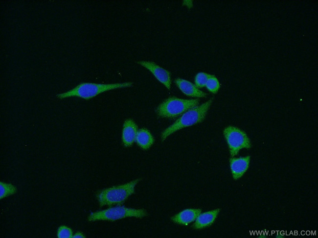 Aurora A Antibody in Immunocytochemistry (ICC/IF)