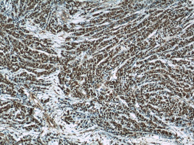 B23/NPM1 Antibody in Immunohistochemistry (Paraffin) (IHC (P))