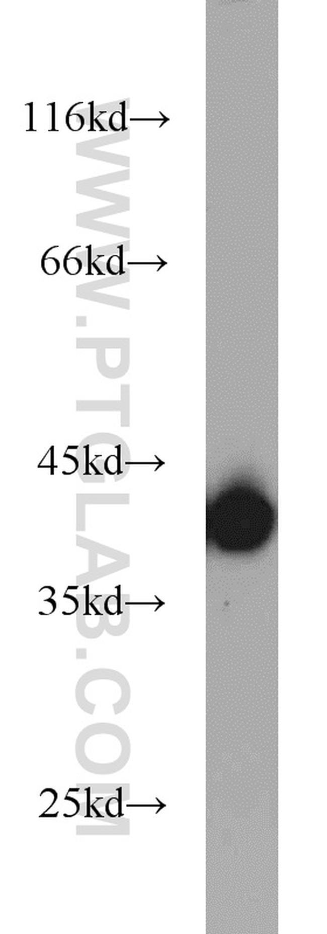 B23/NPM1 Antibody in Western Blot (WB)