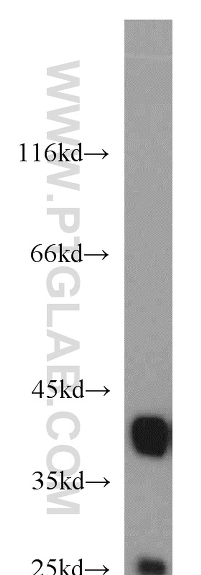 B23/NPM1 Antibody in Western Blot (WB)