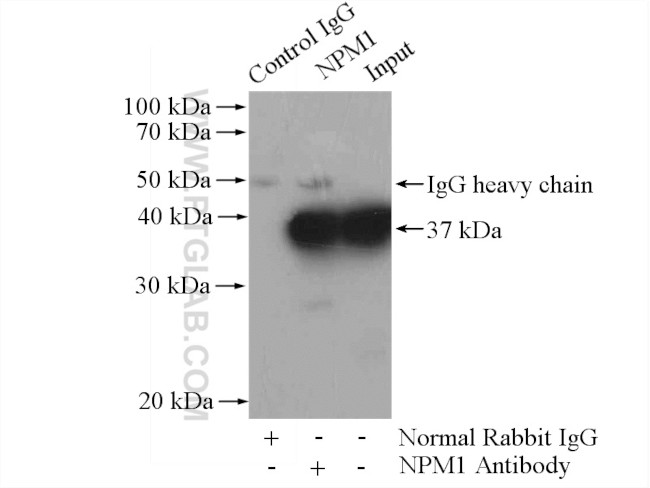 B23/NPM1 Antibody in Immunoprecipitation (IP)