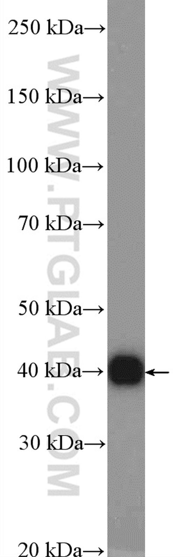 AMPK beta 1 Antibody in Western Blot (WB)