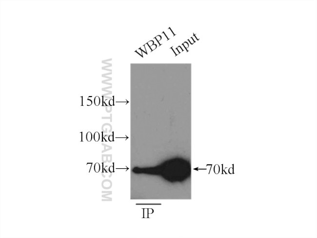 WBP11 Antibody in Immunoprecipitation (IP)