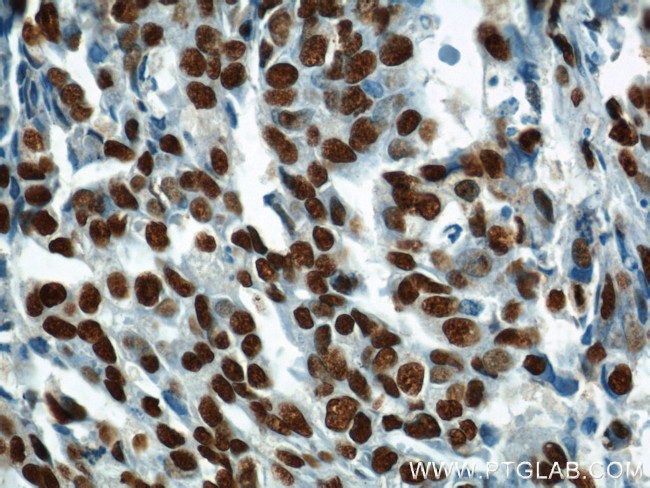 MAD2L1 Antibody in Immunohistochemistry (Paraffin) (IHC (P))