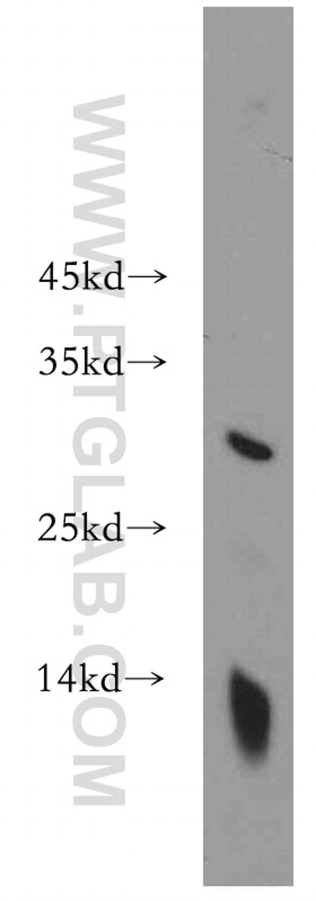 MAD2L1 Antibody in Western Blot (WB)