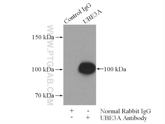 UBE3A Antibody in Immunoprecipitation (IP)