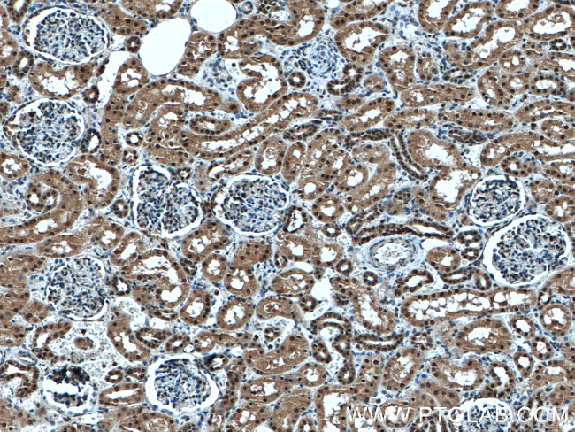 UBE3A Antibody in Immunohistochemistry (Paraffin) (IHC (P))