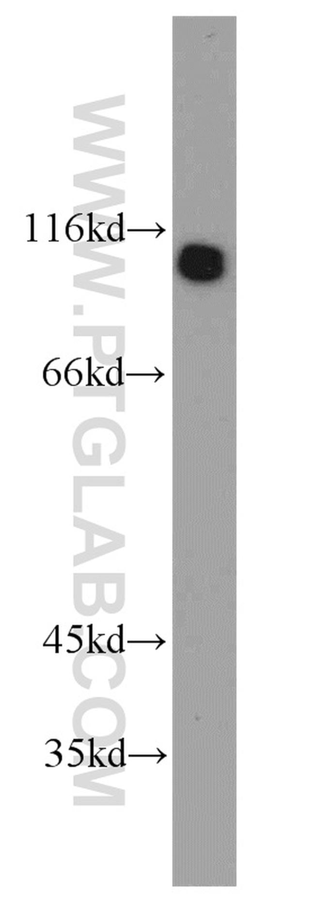 UBE3A Antibody in Western Blot (WB)