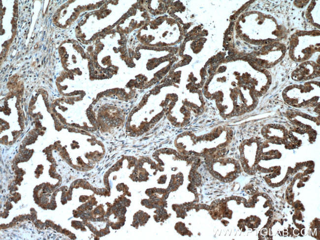 ALDH7A1 Antibody in Immunohistochemistry (Paraffin) (IHC (P))