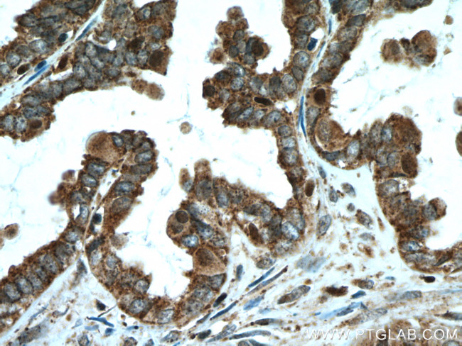 ALDH7A1 Antibody in Immunohistochemistry (Paraffin) (IHC (P))