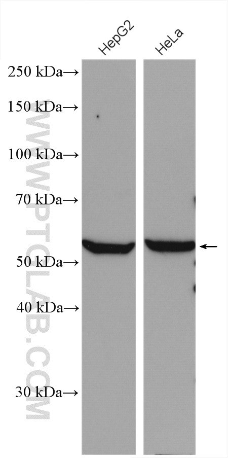 ALDH7A1 Antibody in Western Blot (WB)