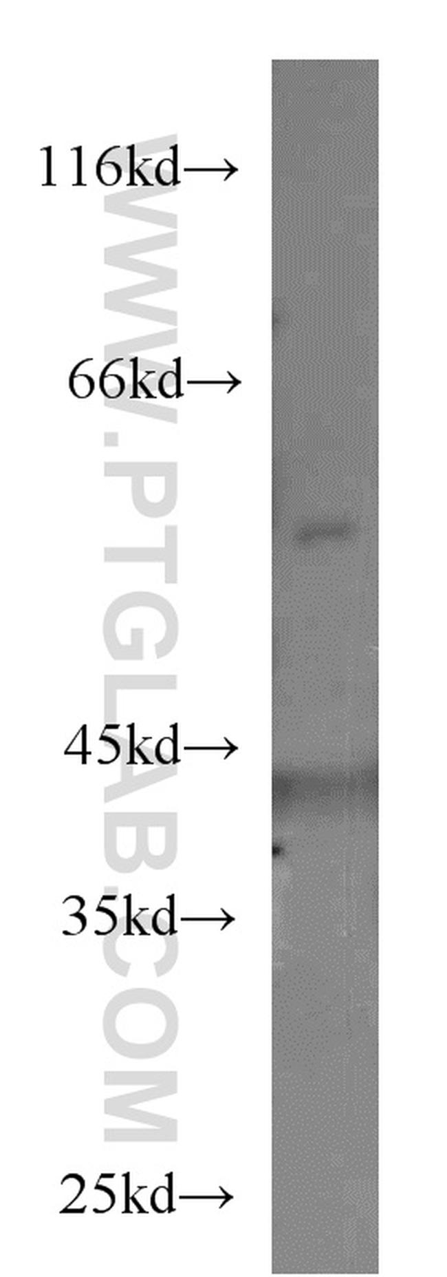 ALDH7A1 Antibody in Western Blot (WB)