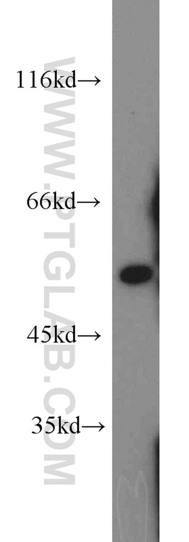 ALDH7A1 Antibody in Western Blot (WB)