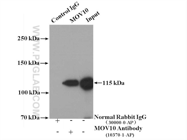 MOV10 Antibody in Immunoprecipitation (IP)