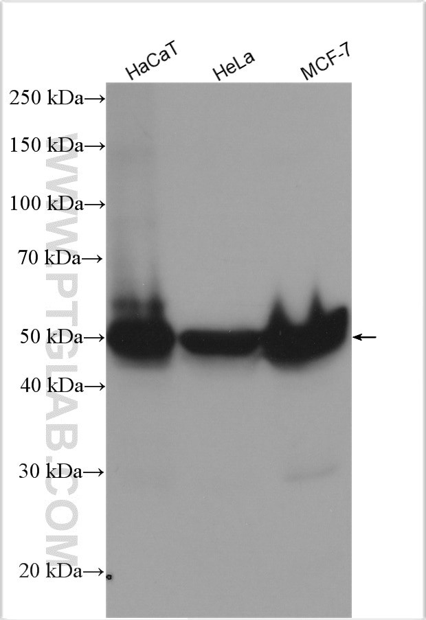 Cytokeratin 8 Antibody in Western Blot (WB)