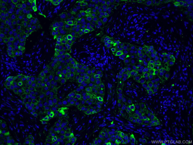 Cytokeratin 8 Antibody in Immunohistochemistry (PFA fixed) (IHC (PFA))