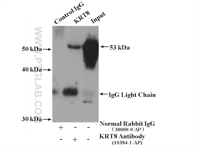 Cytokeratin 8 Antibody in Immunoprecipitation (IP)