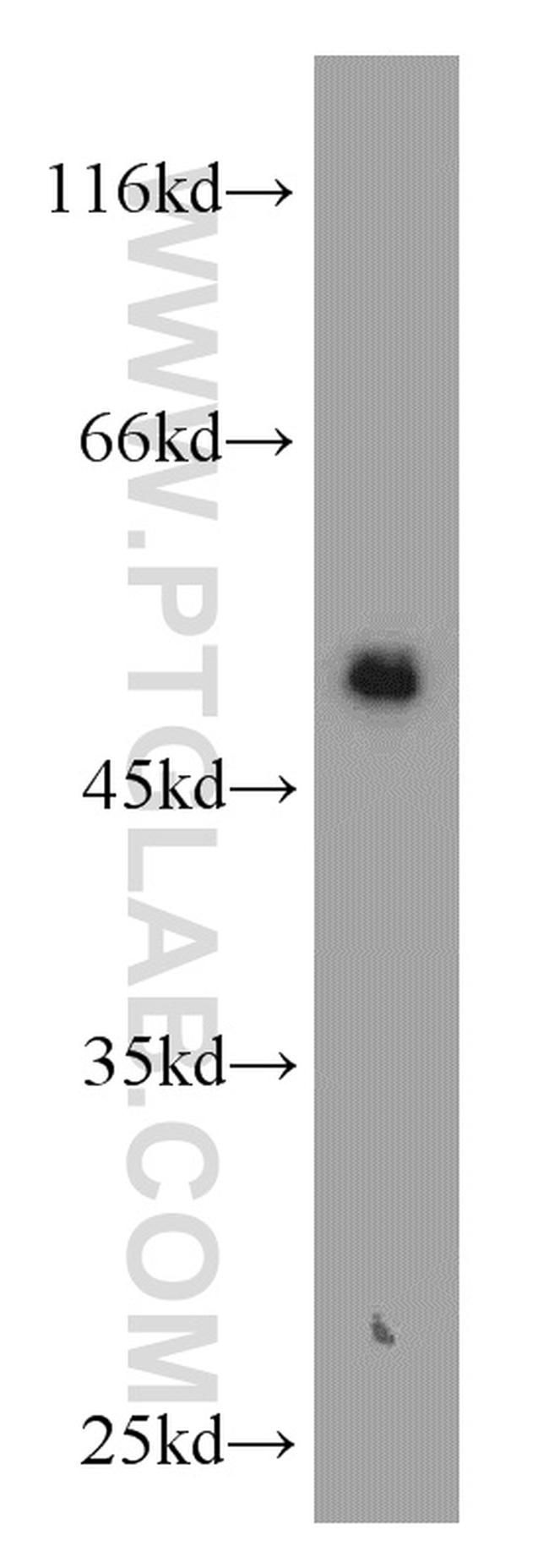 Cytokeratin 8 Antibody in Western Blot (WB)