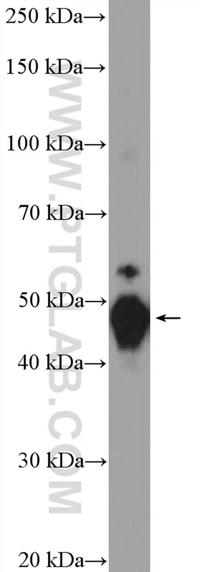 Cytokeratin 8 Antibody in Western Blot (WB)