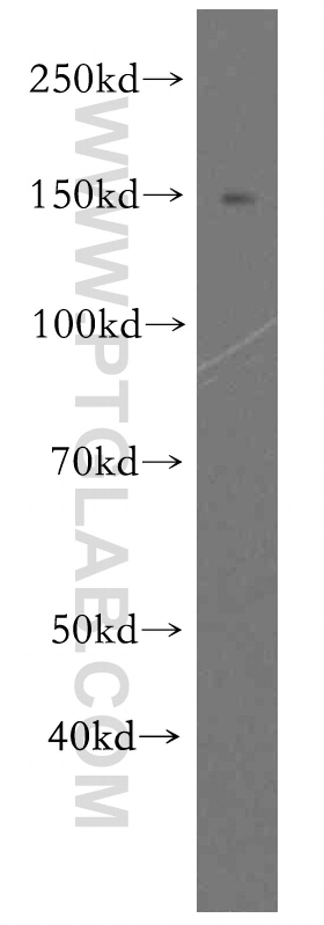 FMNL1 Antibody in Western Blot (WB)