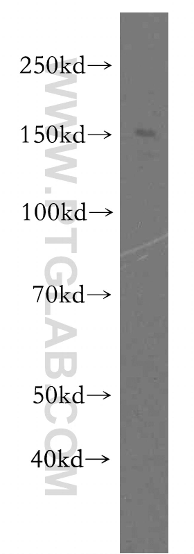 FMNL1 Antibody in Western Blot (WB)