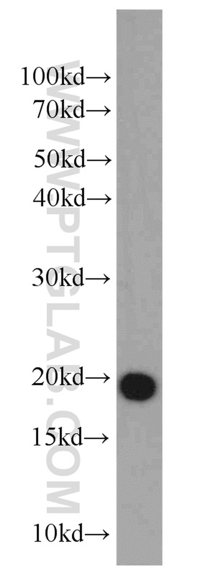 DR1 Antibody in Western Blot (WB)