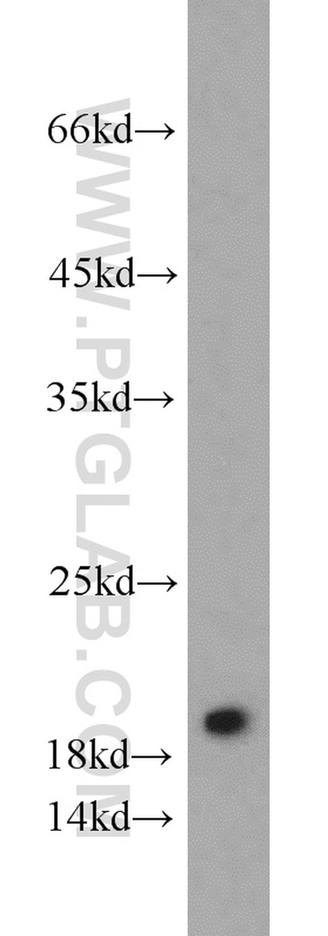 DR1 Antibody in Western Blot (WB)