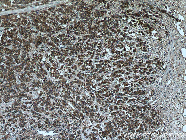 BAD Antibody in Immunohistochemistry (Paraffin) (IHC (P))