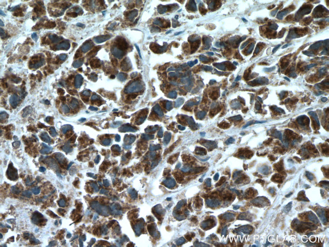 BAD Antibody in Immunohistochemistry (Paraffin) (IHC (P))