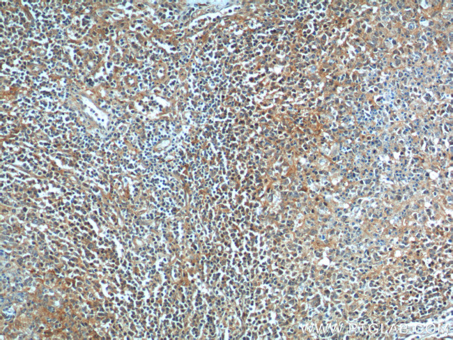 BAD Antibody in Immunohistochemistry (Paraffin) (IHC (P))