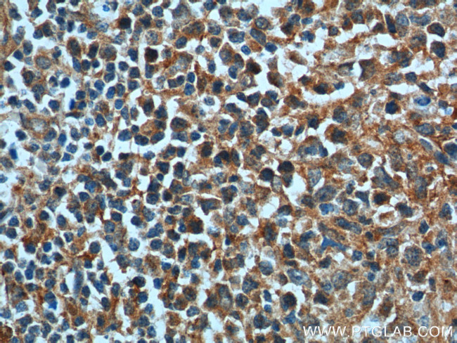 BAD Antibody in Immunohistochemistry (Paraffin) (IHC (P))