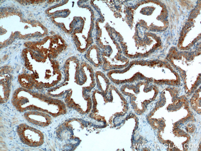 BAD Antibody in Immunohistochemistry (Paraffin) (IHC (P))