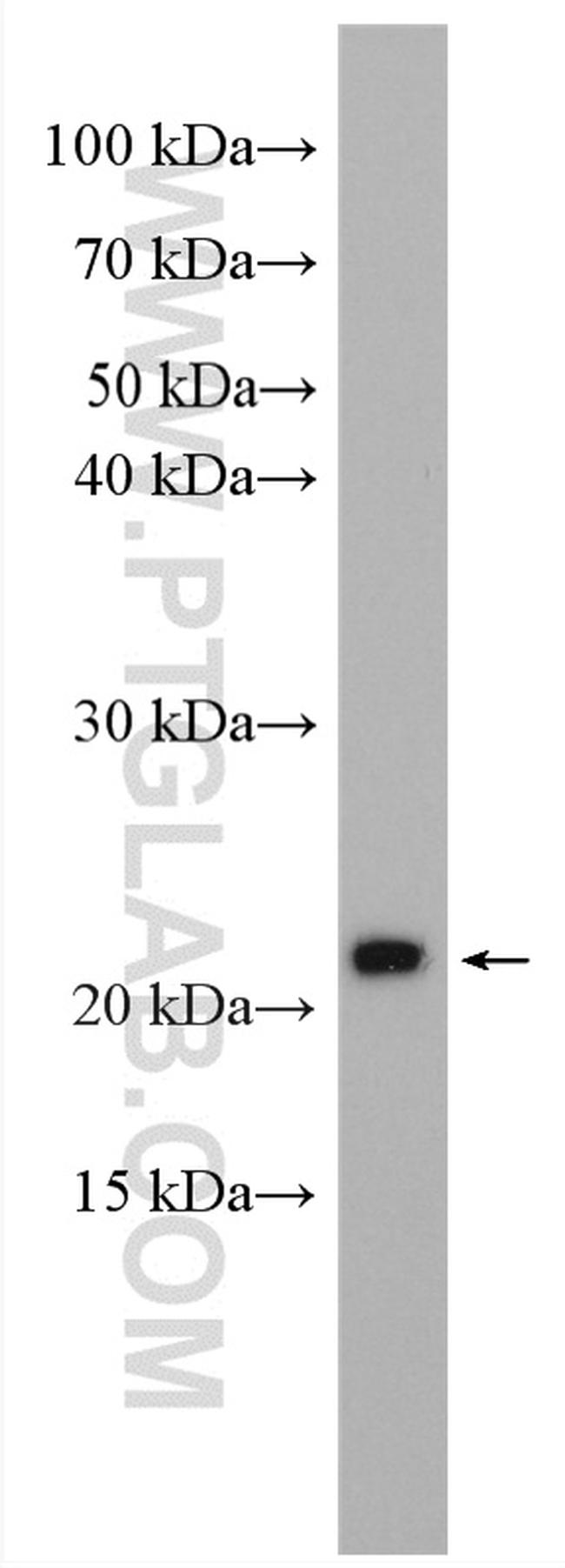 BAD Antibody in Western Blot (WB)