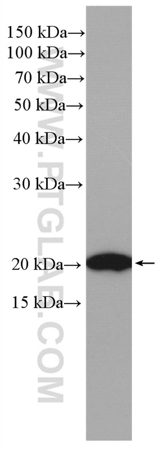 BAD Antibody in Western Blot (WB)