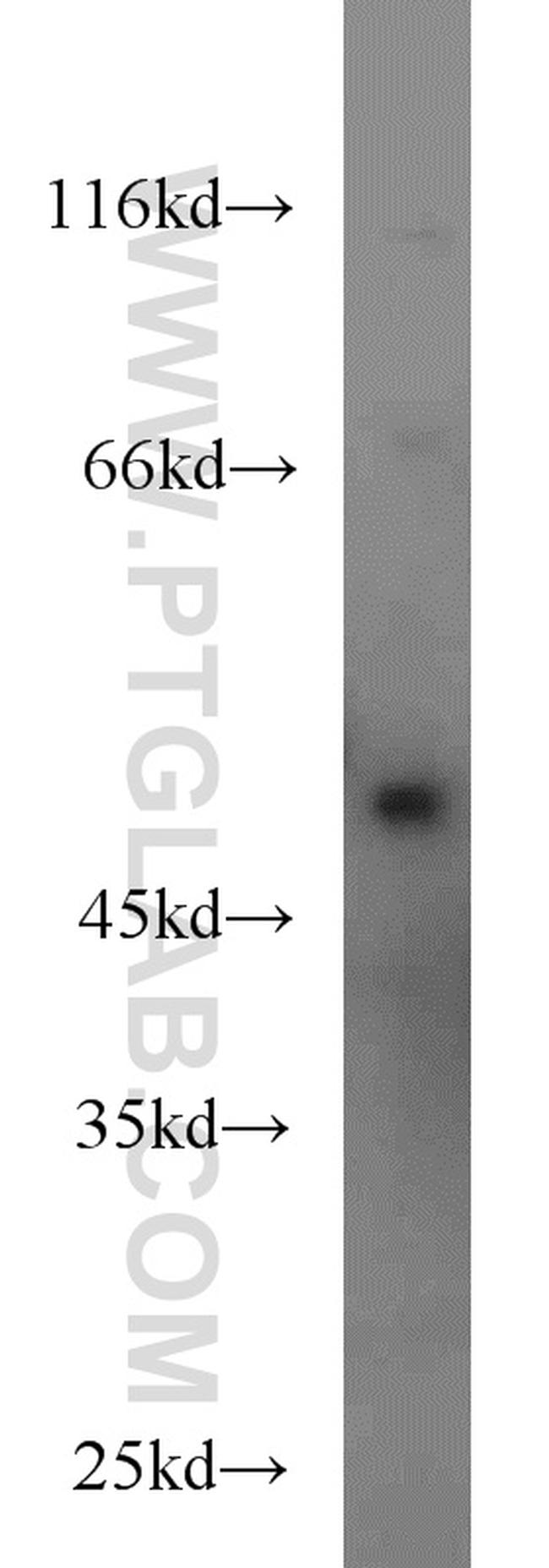 Caspase 2/p18 Antibody in Western Blot (WB)