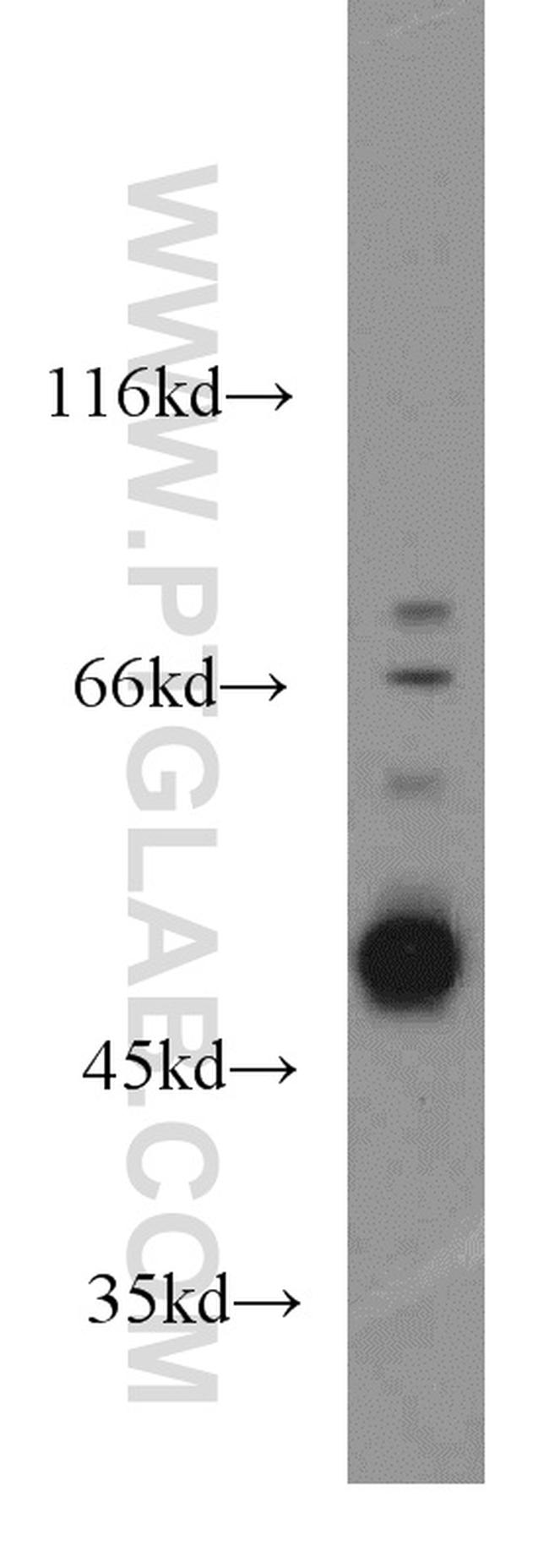 Caspase 2/p18 Antibody in Western Blot (WB)