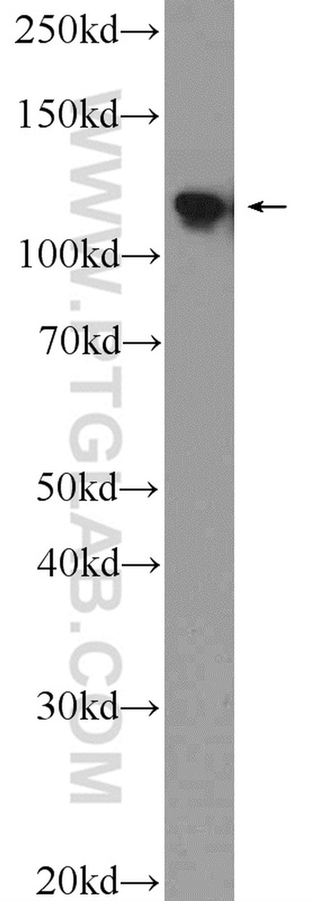 NOP2 Antibody in Western Blot (WB)