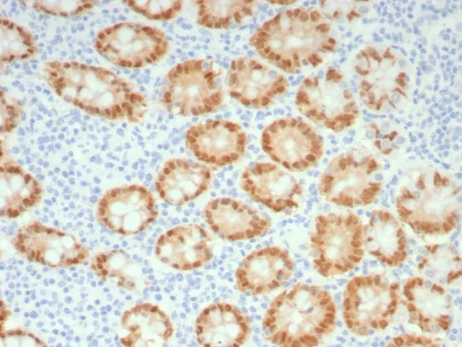 CDX2/Caudal Type Homeobox 2 (GI Epithelial Marker) Antibody in Immunohistochemistry (Paraffin) (IHC (P))