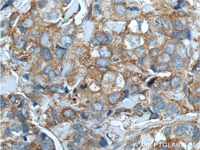 CXCL14 Antibody in Immunohistochemistry (Paraffin) (IHC (P))