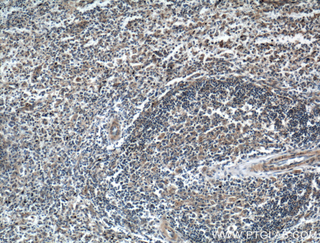 USP5 Antibody in Immunohistochemistry (Paraffin) (IHC (P))