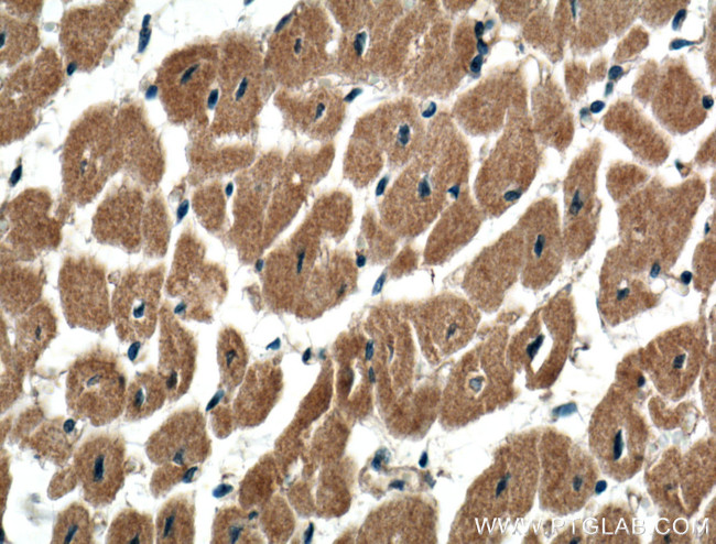 USP5 Antibody in Immunohistochemistry (Paraffin) (IHC (P))