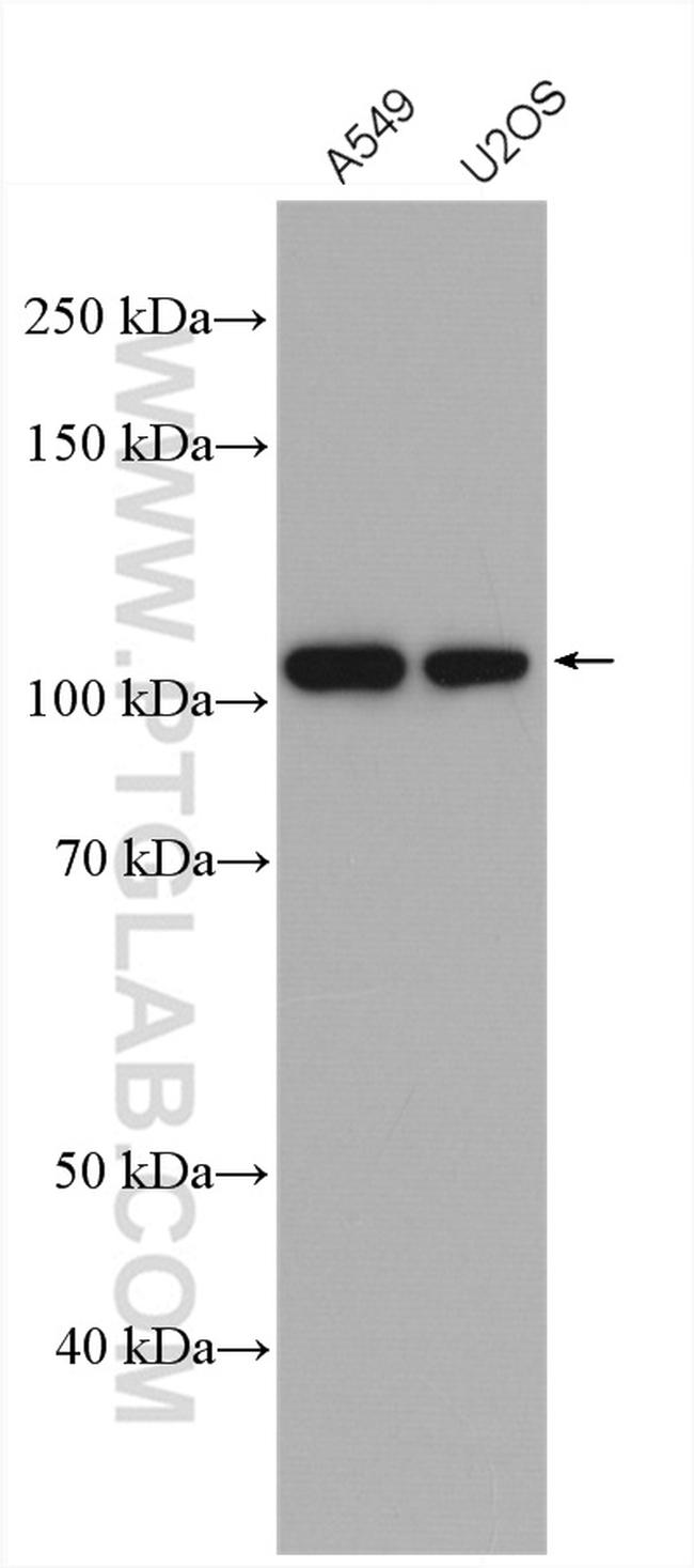 USP5 Antibody in Western Blot (WB)