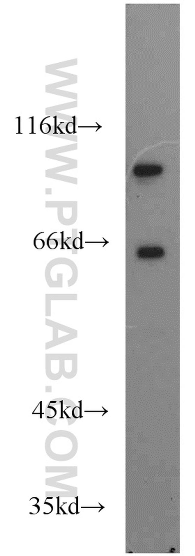 USP5 Antibody in Western Blot (WB)