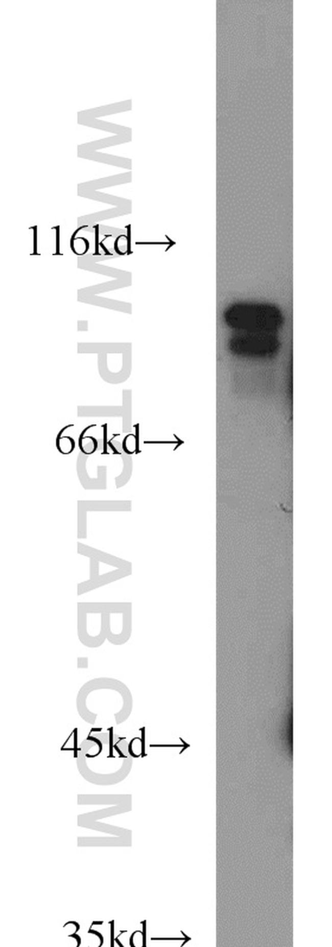 USP5 Antibody in Western Blot (WB)