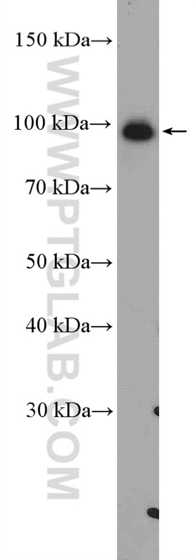 USP5 Antibody in Western Blot (WB)