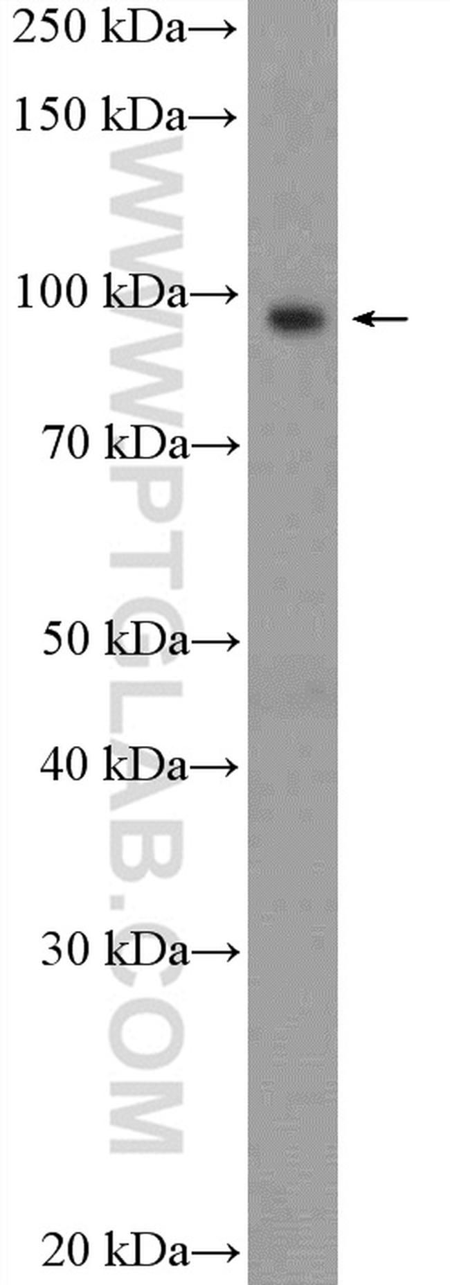 USP5 Antibody in Western Blot (WB)